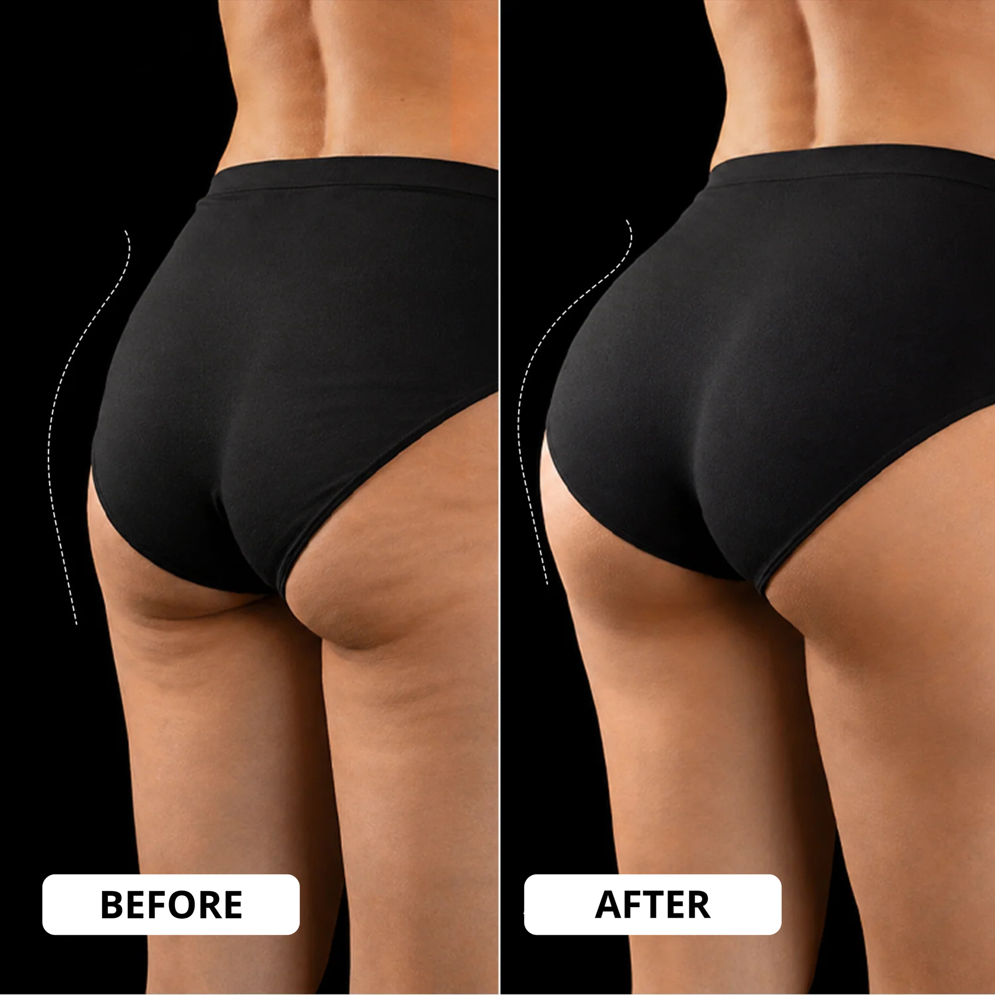 Clorans® EMS Toning Shorts